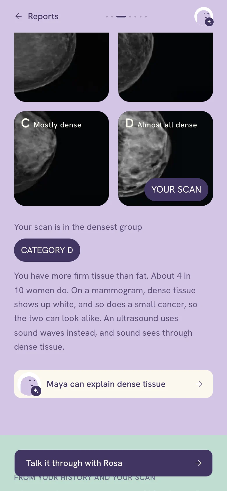 The density band, scrolled: You have more firm tissue than fat. About 4 in 10 women do. On a mammogram, dense tissue shows up white, and so does a small cancer, so the two can look alike. An ultrasound uses sound waves and sees through dense tissue. Then the door: Maya can explain dense tissue.